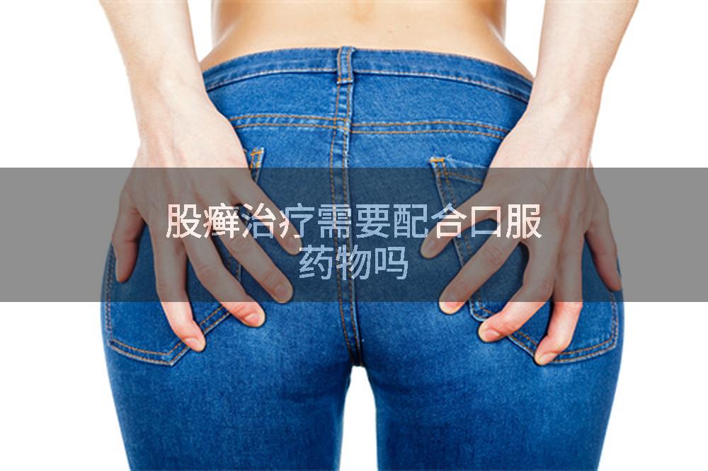股癣治疗需要配合口服药物吗
