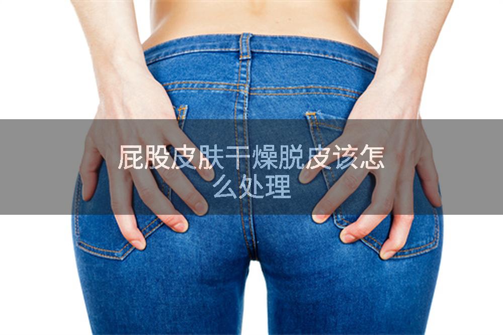 屁股皮肤干燥脱皮该怎么处理