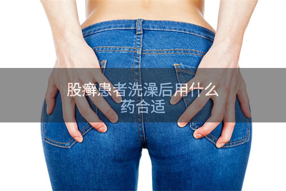 股癣患者洗澡后用什么药合适