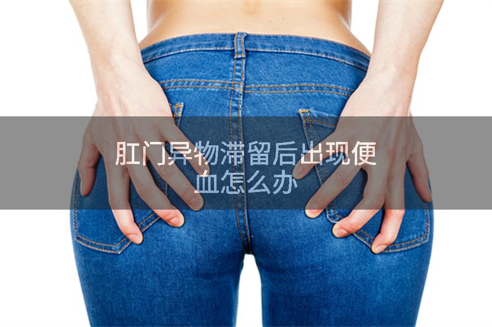 肛门异物滞留后出现便血怎么办
