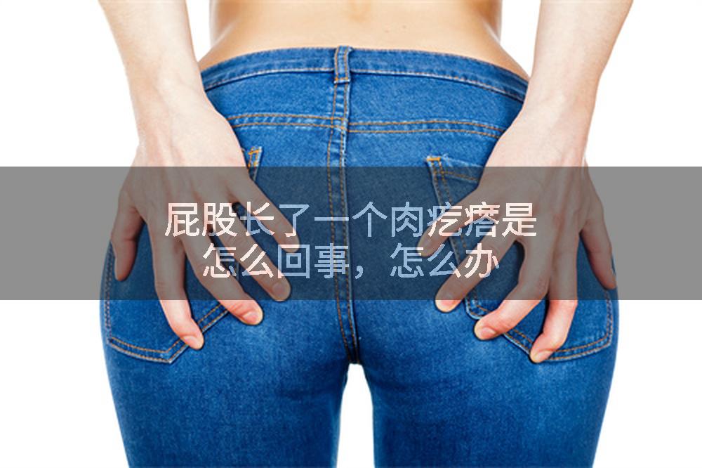 屁股长了一个肉疙瘩是怎么回事，怎么办