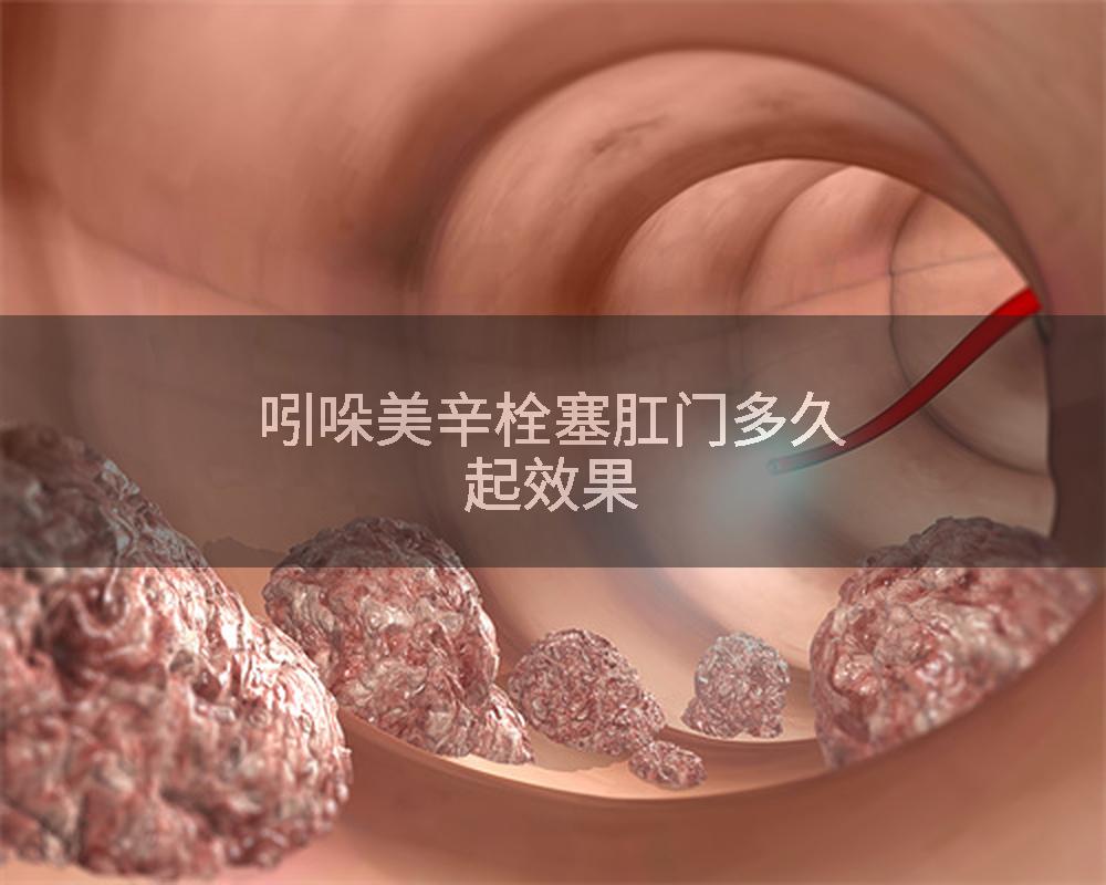 吲哚美辛栓塞肛门多久起效果