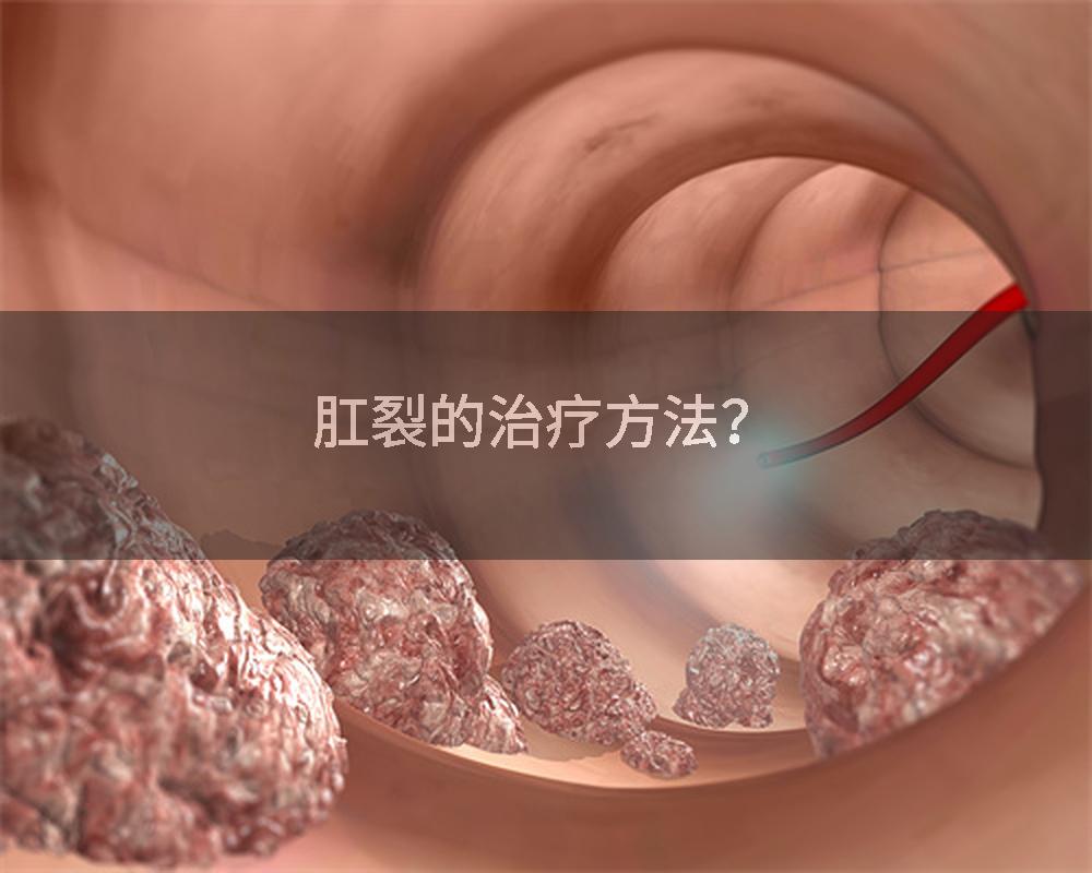 肛裂的治疗方法？