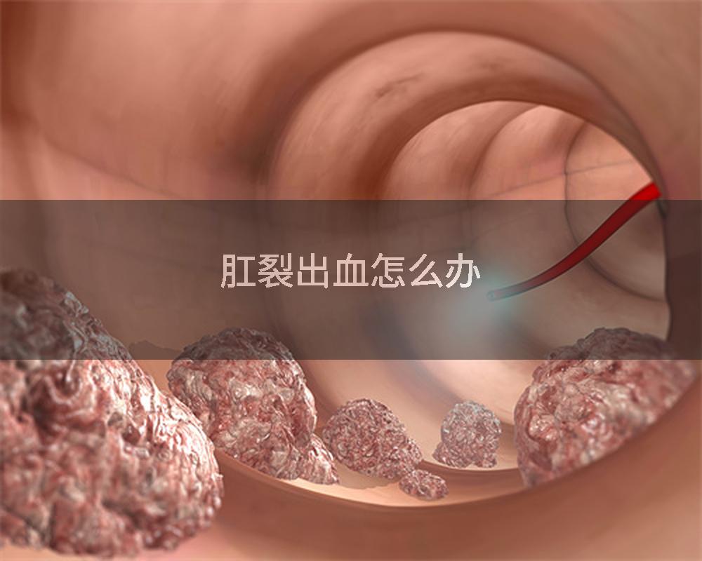 肛裂出血怎么办