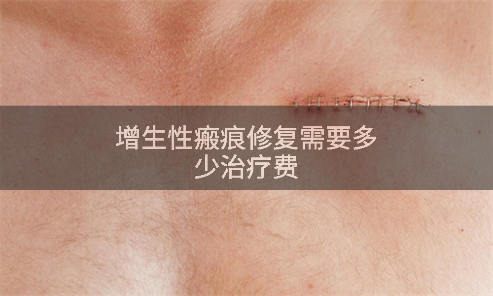增生性瘢痕修复需要多少治疗费