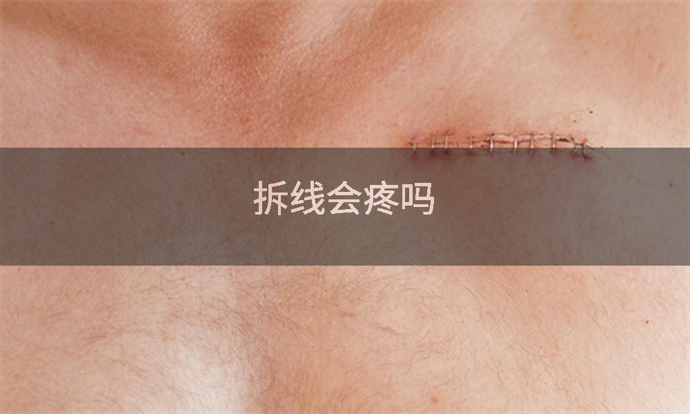 拆线会疼吗