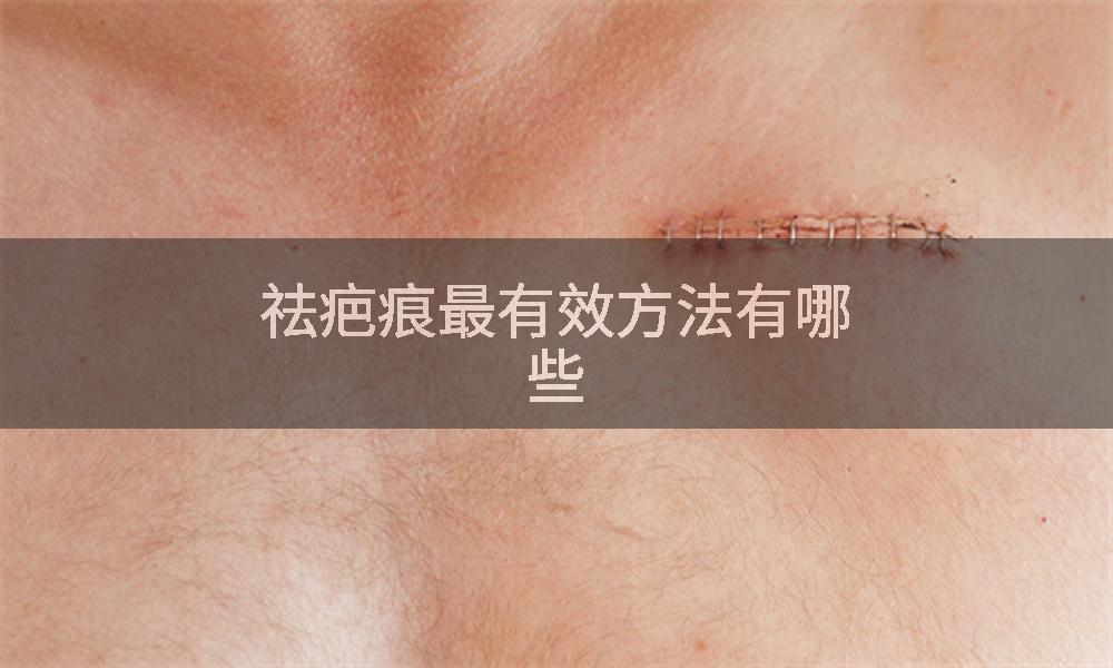 祛疤痕最有效方法有哪些