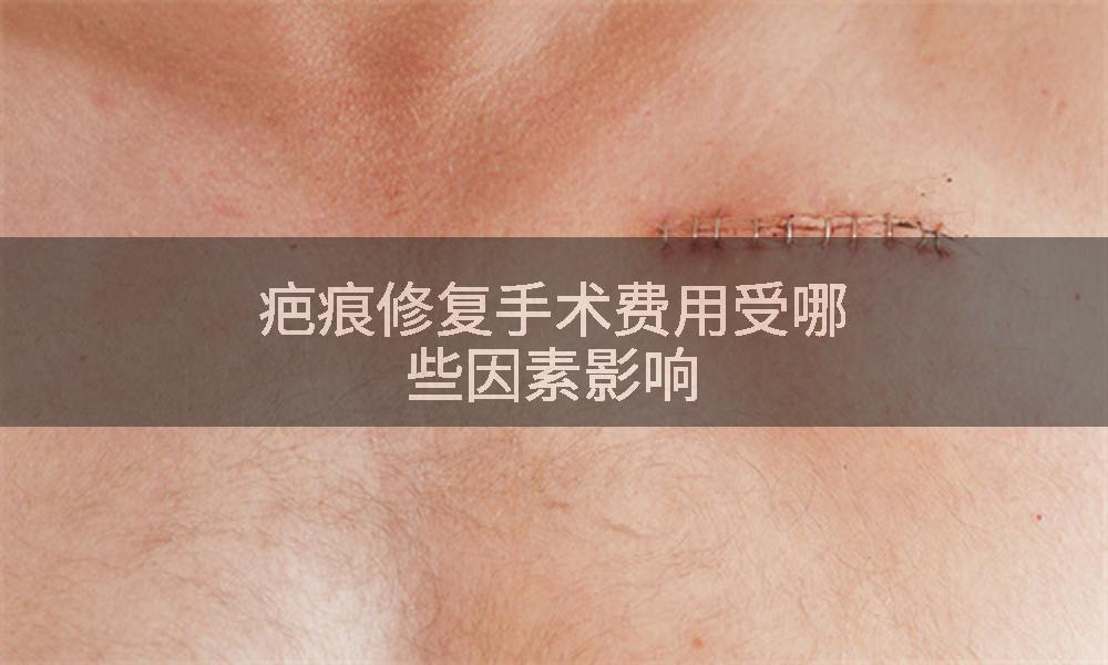 疤痕修复手术费用受哪些因素影响