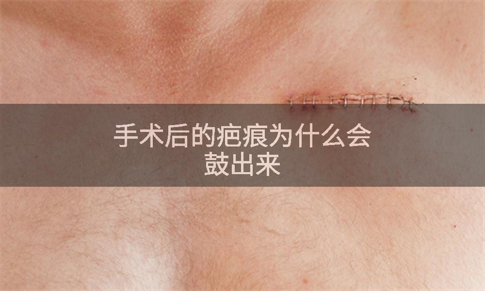 手术后的疤痕为什么会鼓出来