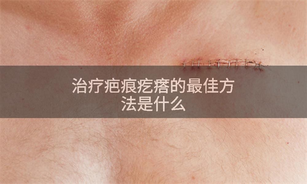 治疗疤痕疙瘩的最佳方法是什么