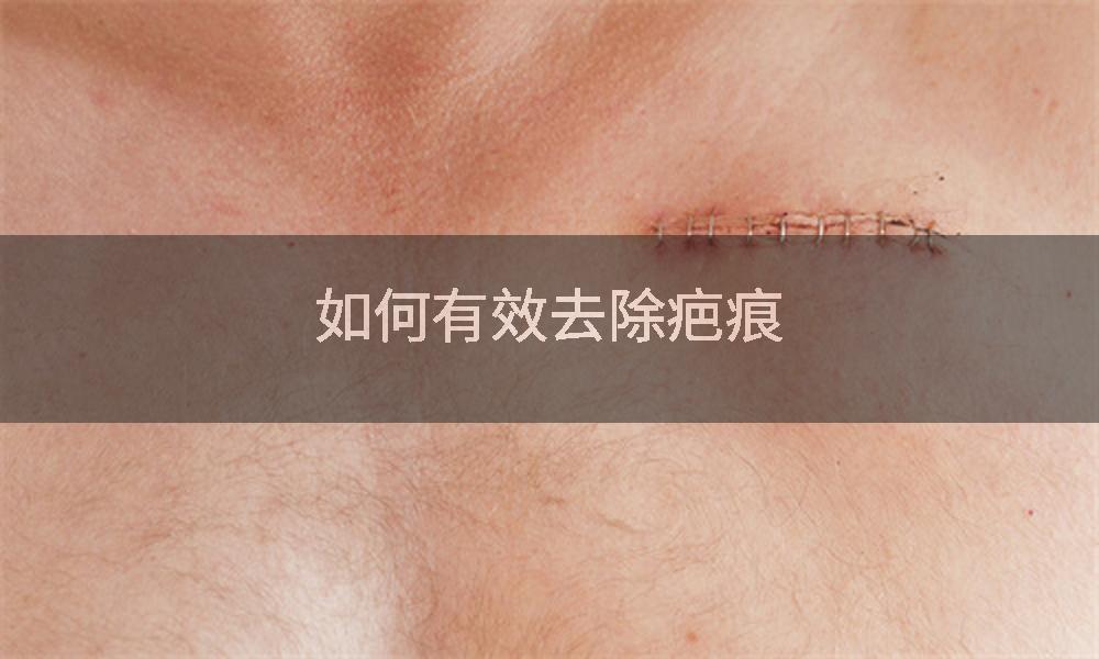 如何有效去除疤痕