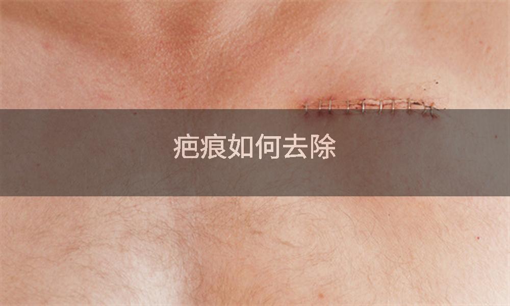 疤痕如何去除