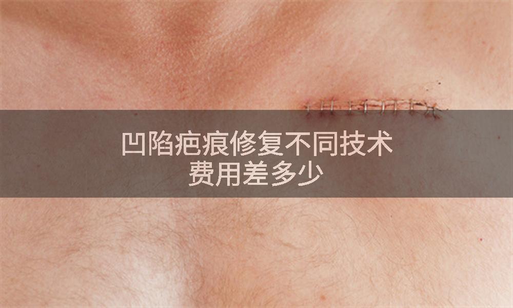 凹陷疤痕修复不同技术费用差多少