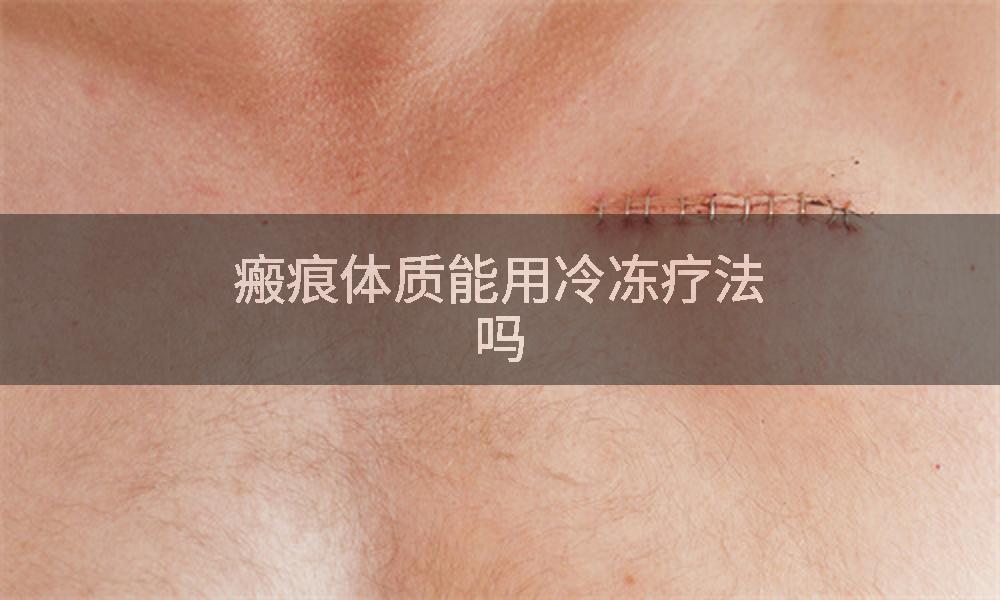 瘢痕体质能用冷冻疗法吗