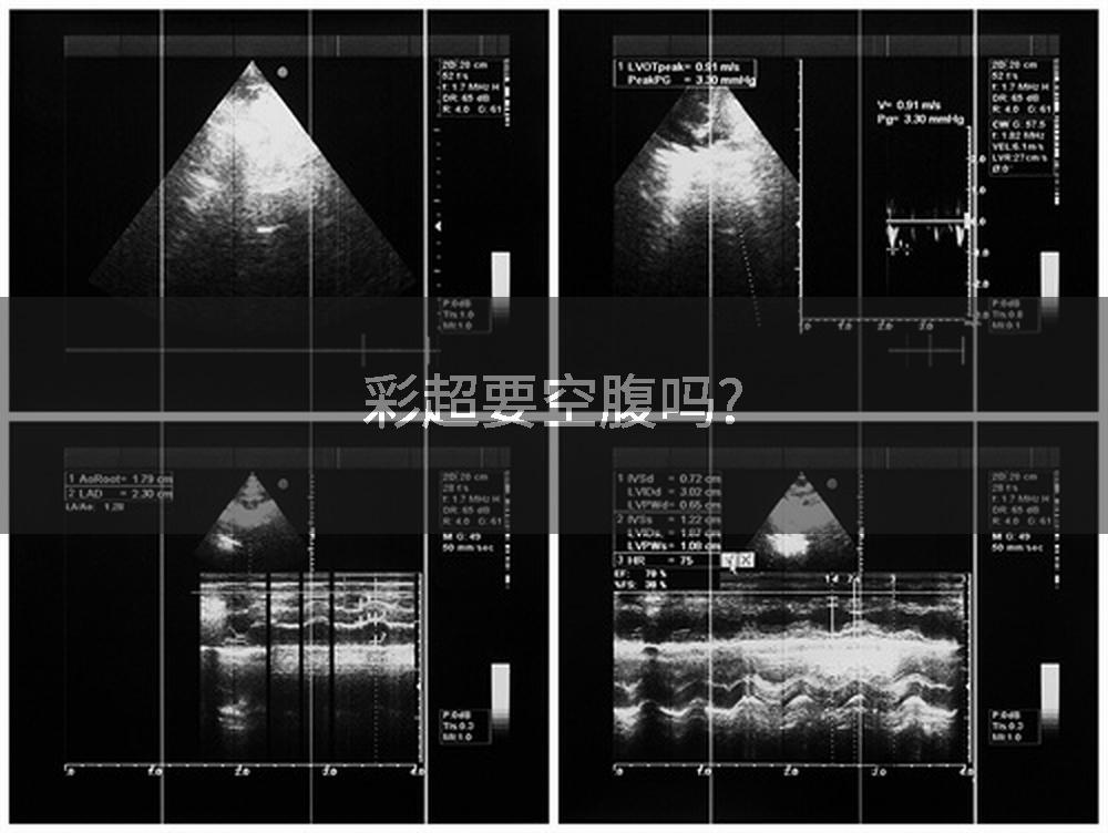 彩超要空腹吗?