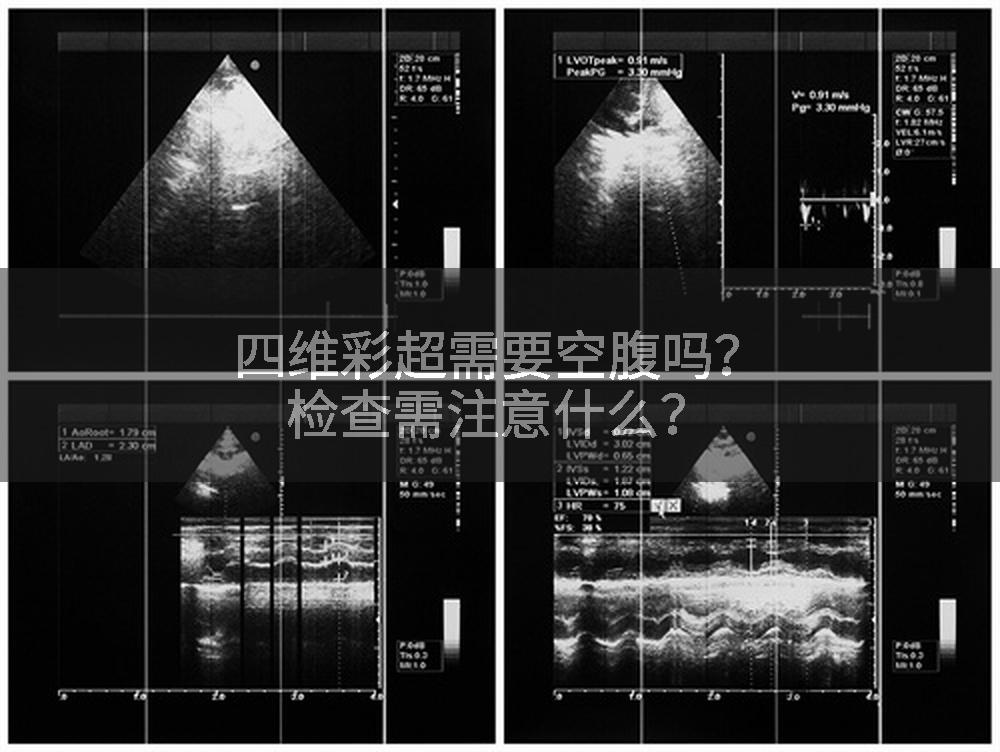 四维彩超需要空腹吗？检查需注意什么？
