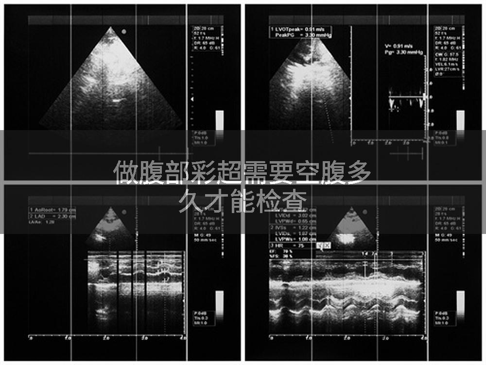 做腹部彩超需要空腹多久才能检查