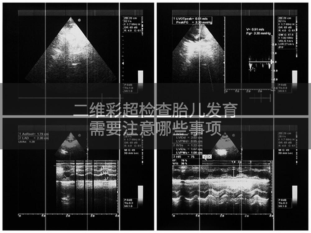 二维彩超检查胎儿发育需要注意哪些事项