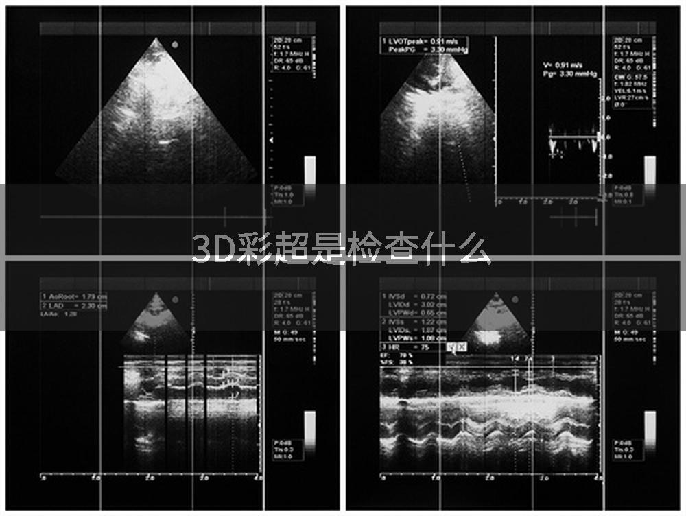 3D彩超是检查什么