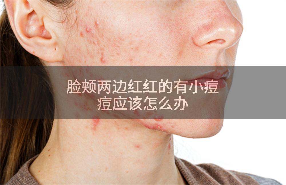 脸颊两边红红的有小痘痘应该怎么办