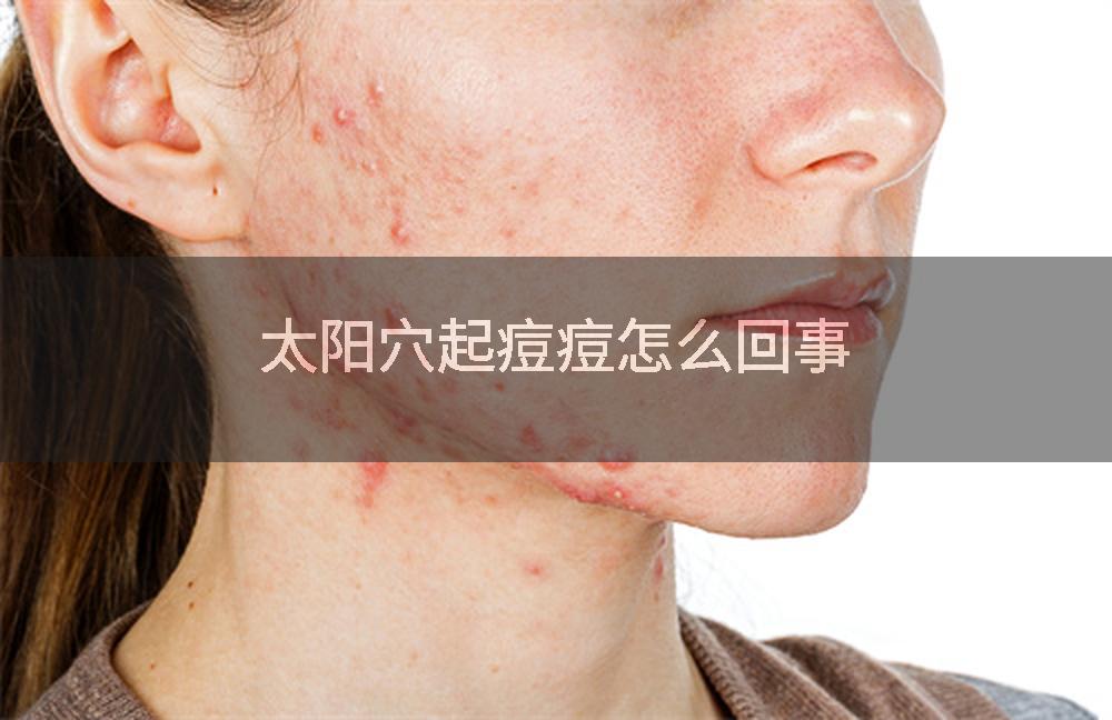 太阳穴起痘痘怎么回事