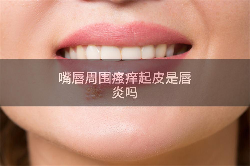嘴唇周围瘙痒起皮是唇炎吗