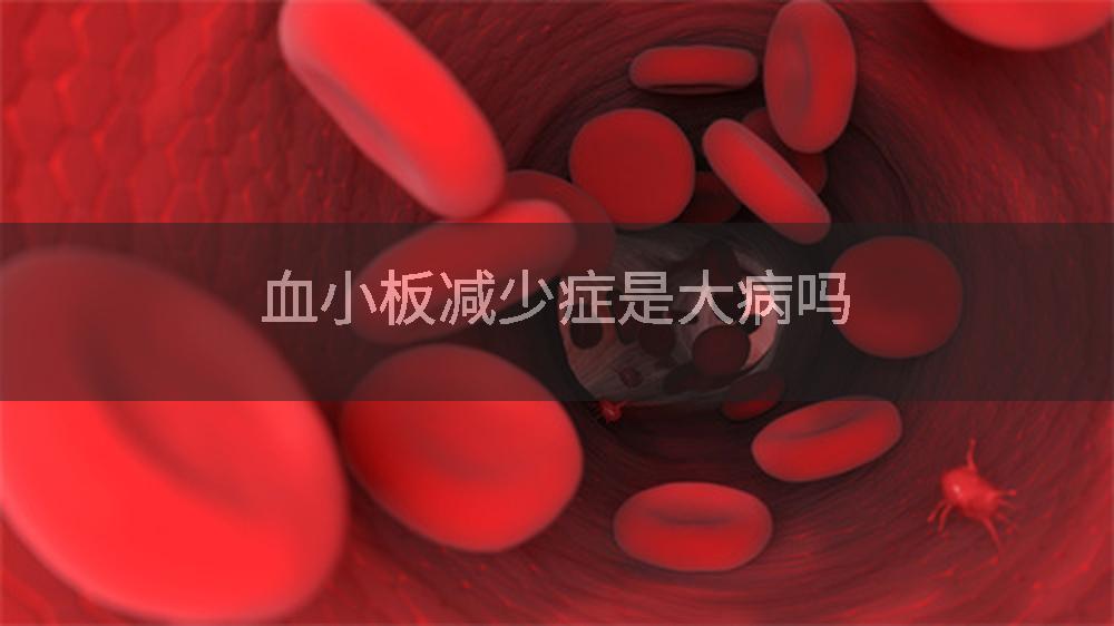 血小板减少症是大病吗