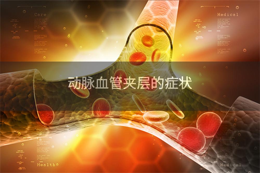 动脉血管夹层的症状