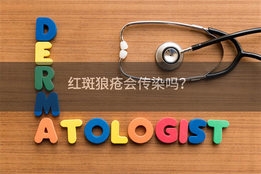 红斑狼疮会传染吗？