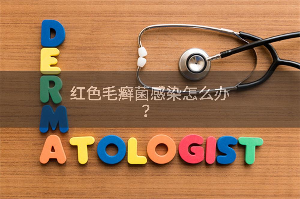 红色毛癣菌感染怎么办？