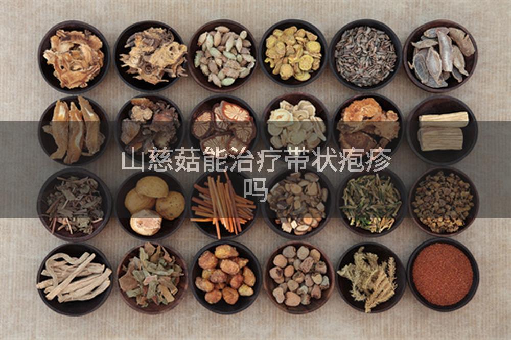山慈菇能治疗带状疱疹吗
