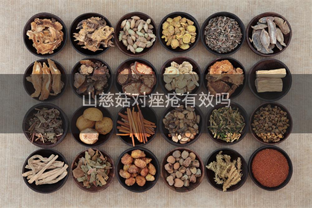 山慈菇对痤疮有效吗