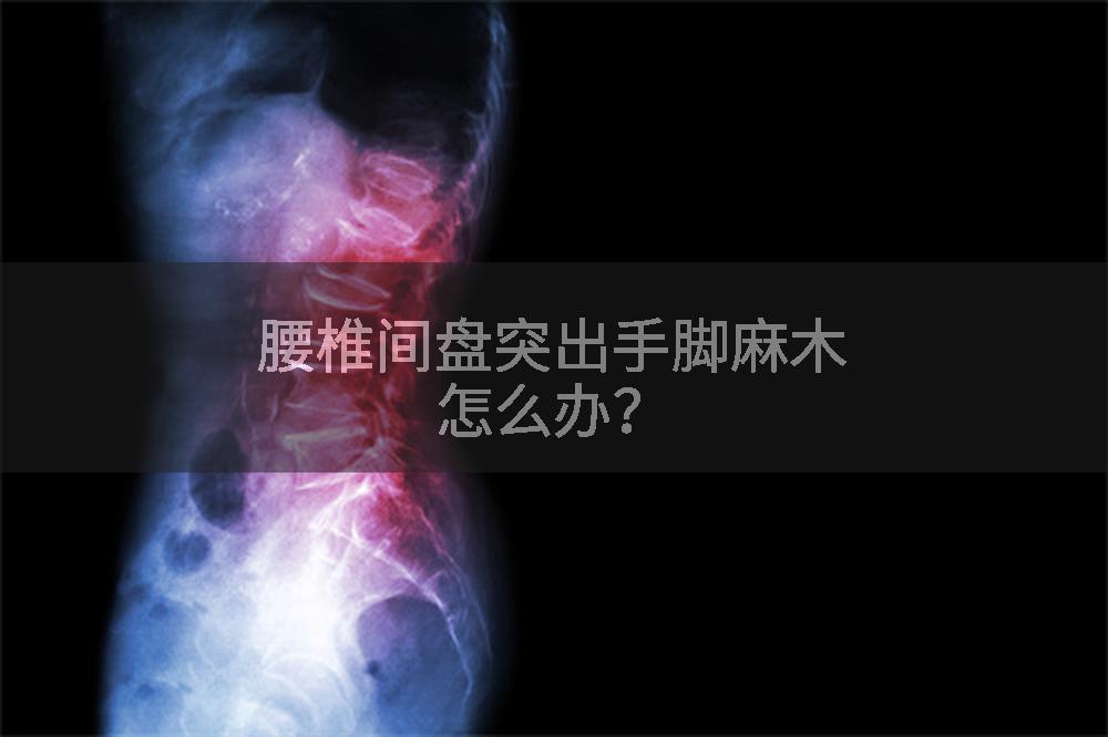腰椎间盘突出手脚麻木怎么办？