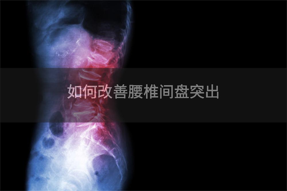 如何改善腰椎间盘突出