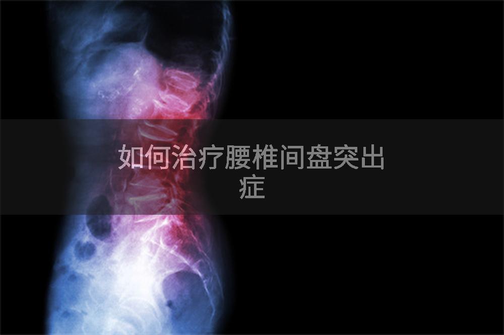 如何治疗腰椎间盘突出症