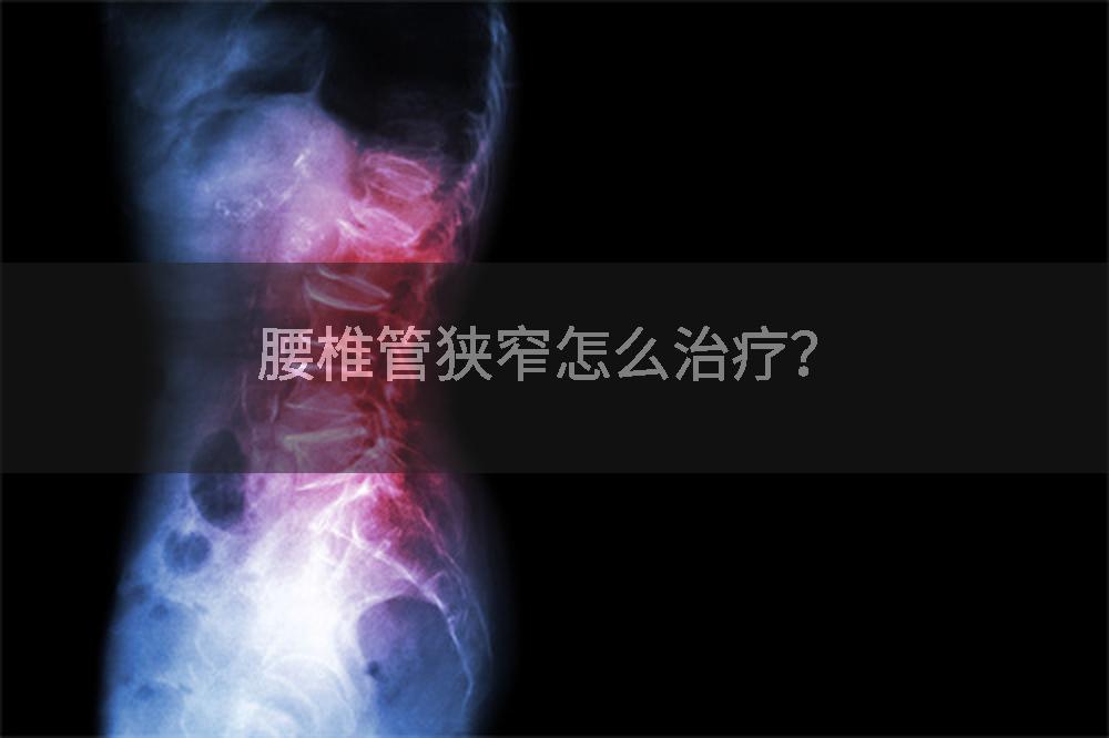 腰椎管狭窄怎么治疗？