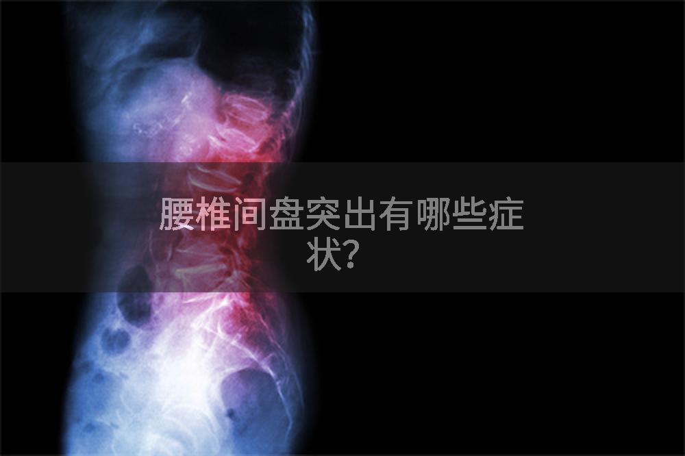 腰椎间盘突出有哪些症状？