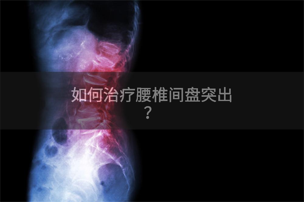 如何治疗腰椎间盘突出？