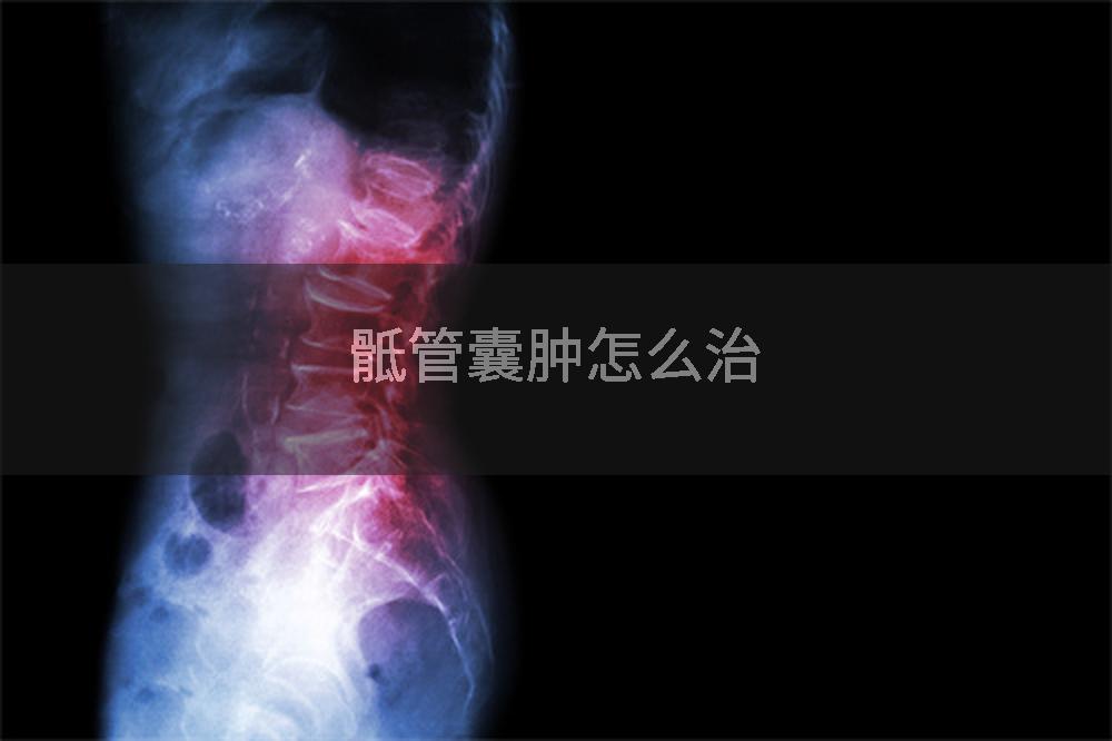 骶管囊肿怎么治
