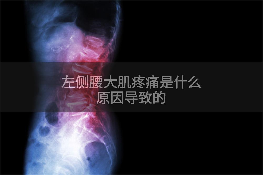 左侧腰大肌疼痛是什么原因导致的