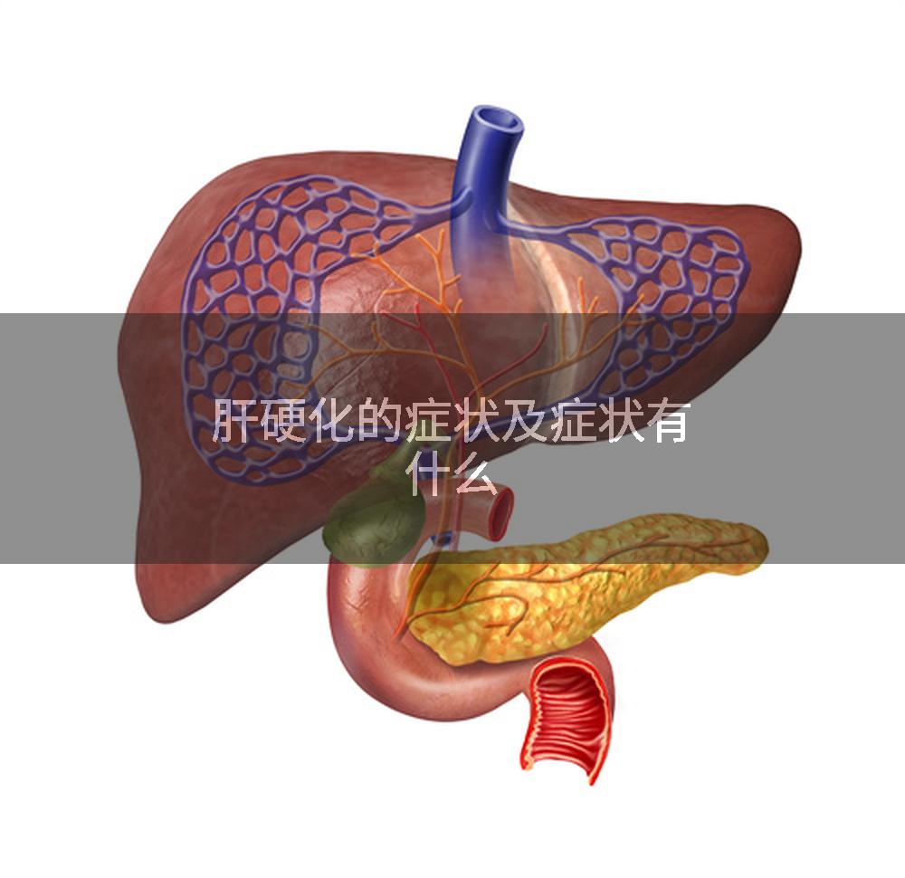 肝硬化的症状及症状有什么