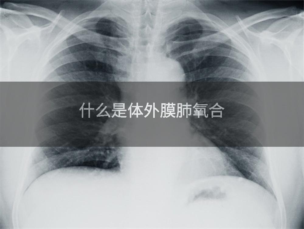 什么是体外膜肺氧合