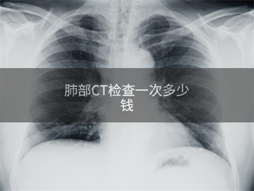 肺部CT检查一次多少钱