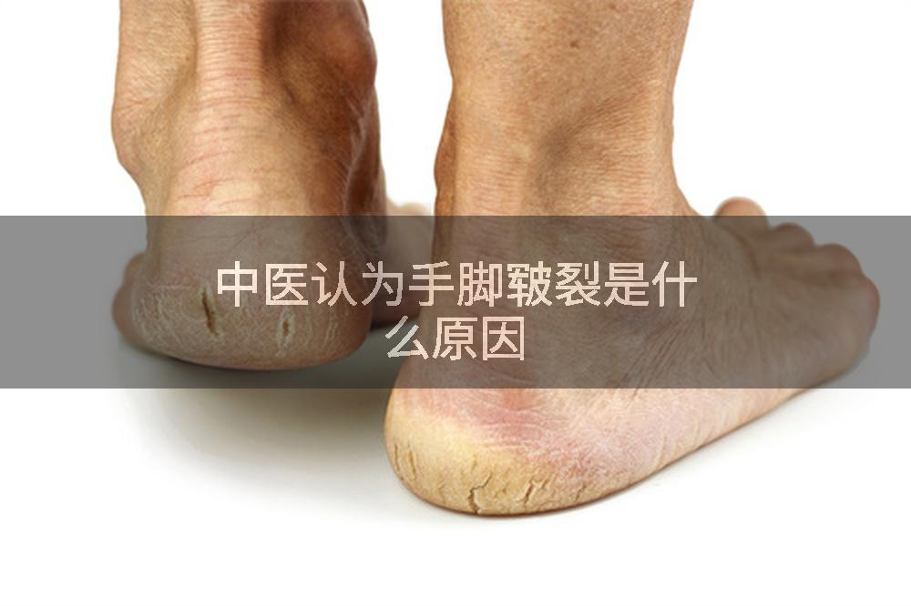 中医认为手脚皲裂是什么原因