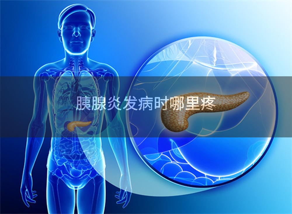 胰腺炎发病时哪里疼