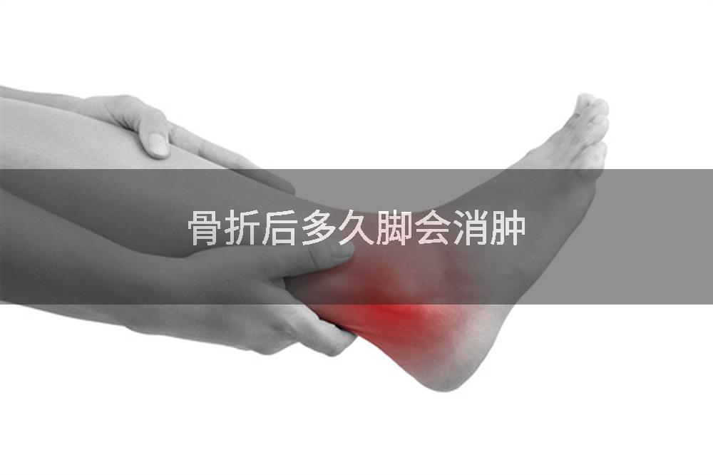 骨折后多久脚会消肿