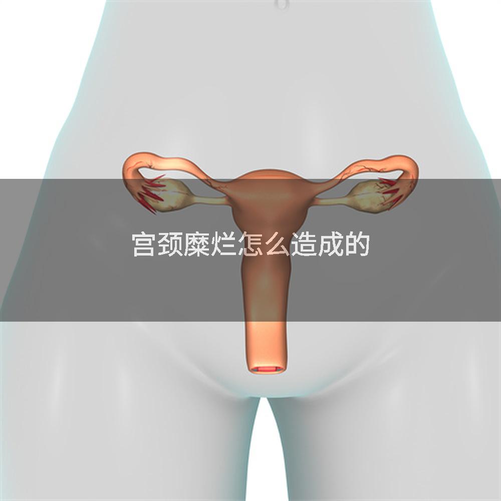 宫颈糜烂怎么造成的