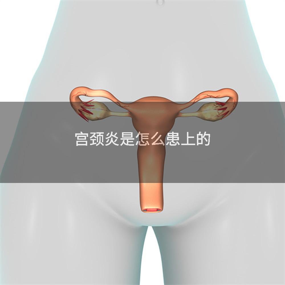 宫颈炎是怎么患上的