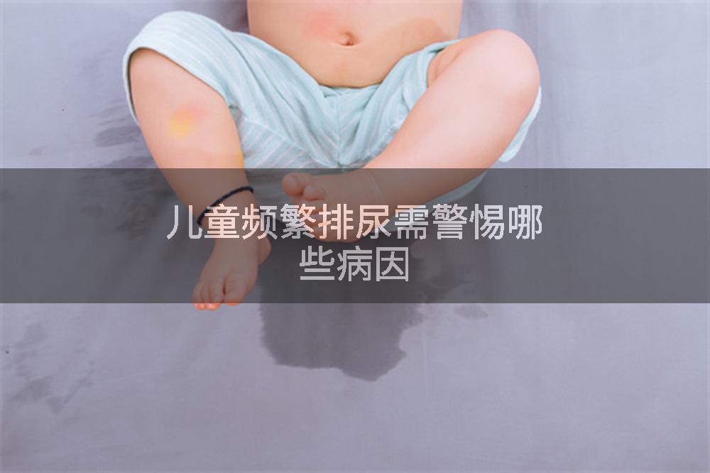 儿童频繁排尿需警惕哪些病因