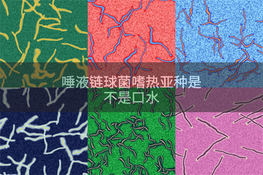 唾液链球菌嗜热亚种是不是口水